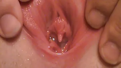Crni penis street thai porn za Remyja Lacroixa